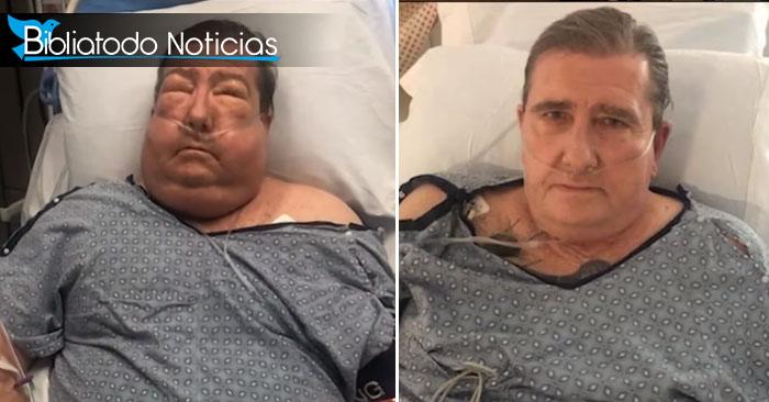 Médicos lo llaman el "Hombre milagro" tras recuperarse de Covid-19 y graves lesiones pulmonares