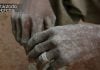 Hombre en Uganda se queda sin manos tras renunciar al islam para seguir a Cristo Hombre en Uganda se queda sin manos tras renunciar al islam para seguir a Cristo