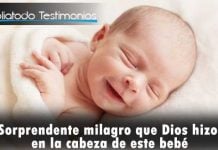 Sorprendente milagro que Dios hizo en la cabeza de este bebé