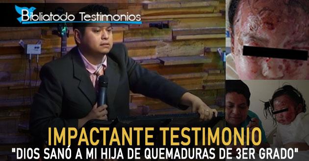 IMPACTANTE TESTIMONIO: "Dios sanó a mi hija de quemaduras de 3er grado"